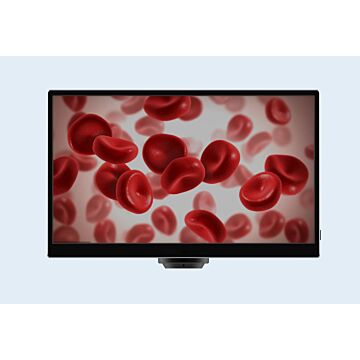 CX3 5.0MP Microscope Camera with 11.6-Inch TFT Display