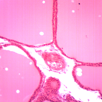 Bone Marrow - Omano OMSK-15HT